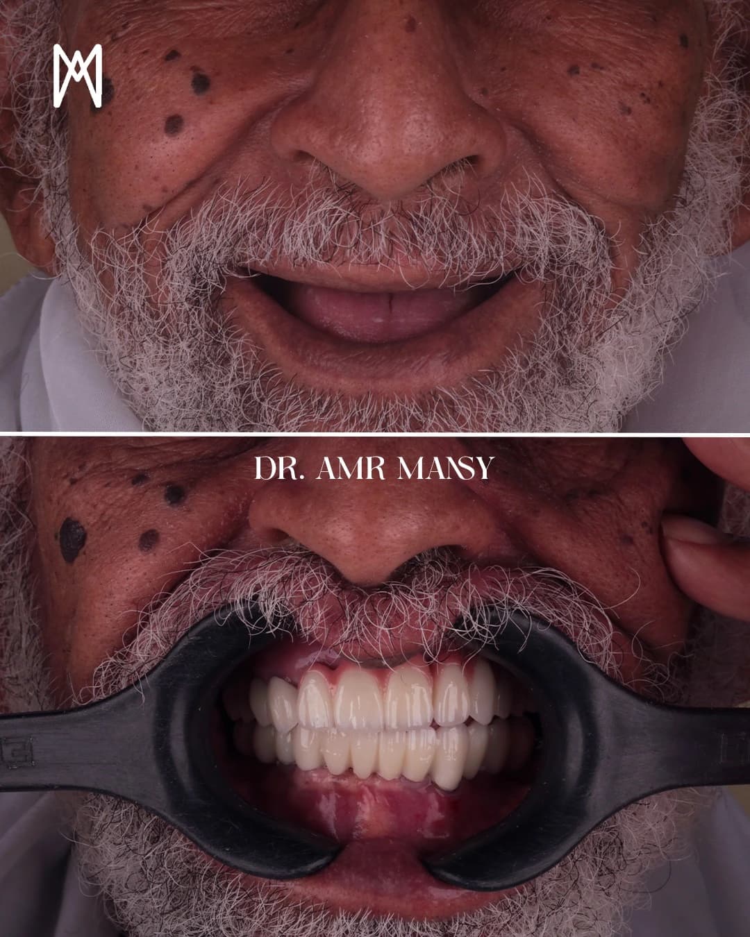 Orthodontic Success4