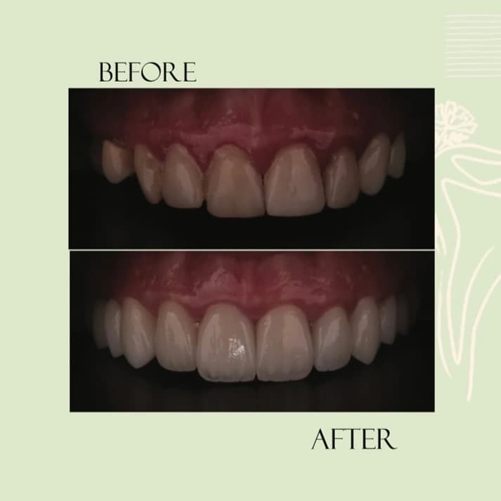 Orthodontic Success5