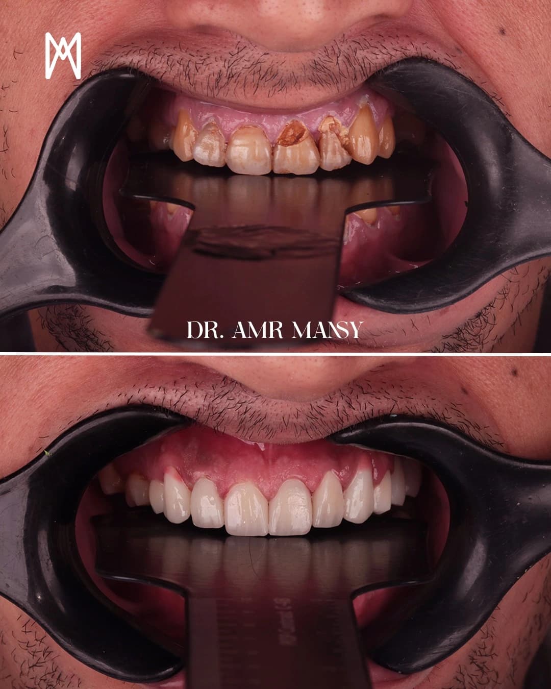 Orthodontic Success5