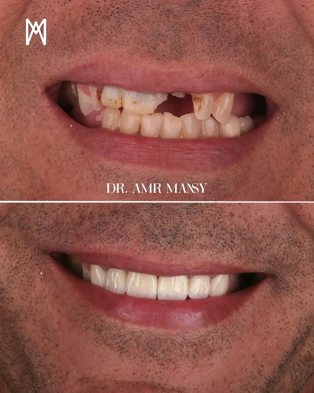 Orthodontic Success5