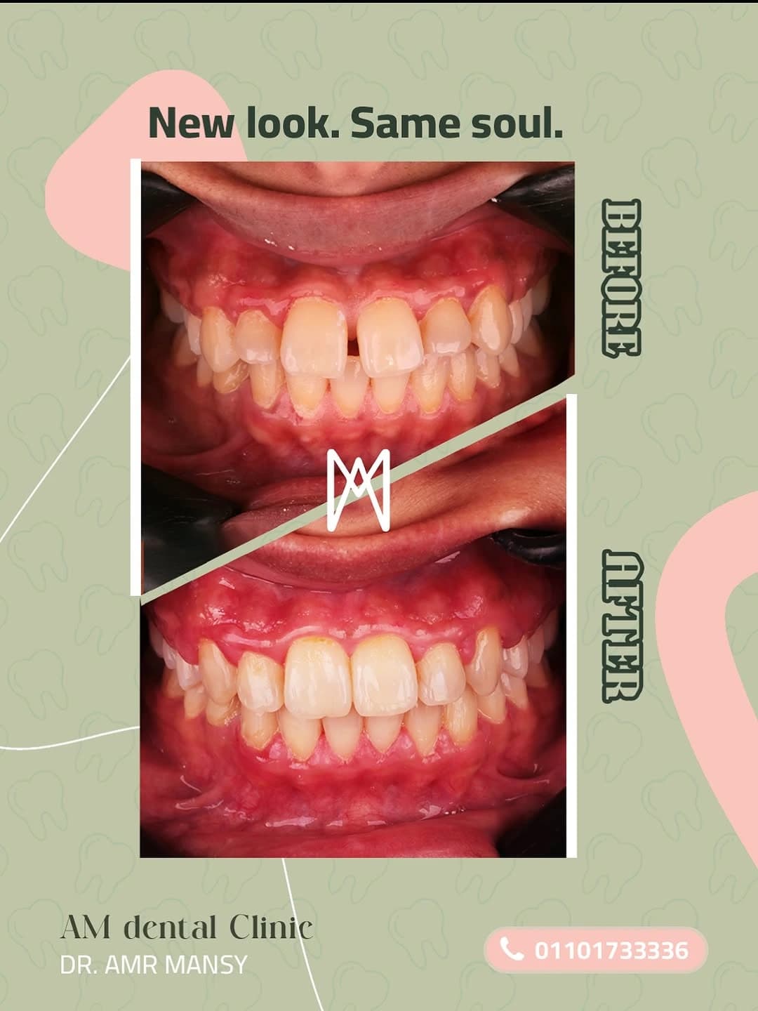 Advanced Orthodontic Transformation